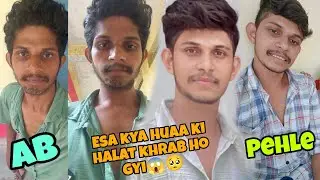 kese huaa Mera Accident  😭||  Pehle Kesa Tha aor Accident Ke Bad Kesa Ho Gya me  🥺|| 