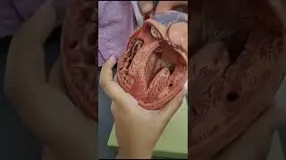 Viscera 3