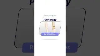 Bone Fractures | Pathology | BioAtlas