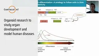 Organoid research to study organ development and model human diseases with Dr. Daniel Krueger