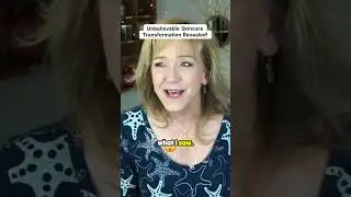 Unbelievable Skincare Transformation Revealed!