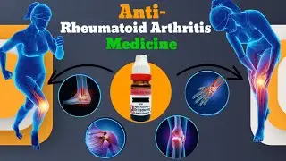 Rheumatoid arthritis treatment | Knee Pain Treatment | Joint Pain Treatment |
