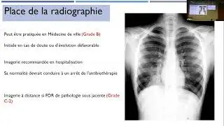 Nouvelles recommandations sur les pneumopathies
