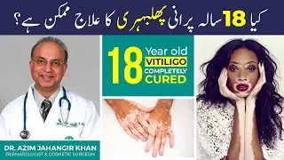 Is Old Vitiligo (Phulbehri) Really Untreatable? The Truth Revealed! | Cosmetique