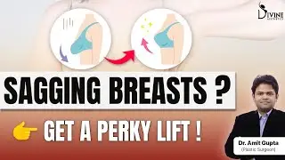 How to Fix Sagging Breasts - Best Breast Lift Technique for Lasting Results | Breast Augmentation