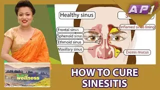 CURING SINUSITIS (PINAS) || HEALTH AND WELLNESS || AP1HD
