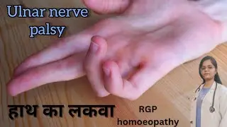 #ulnar nerve palsy #hand paralysis #finger paralysis #lakawa #paralysishomoeopathy #ulnar nerve