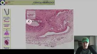 Artery and Vein digital slide