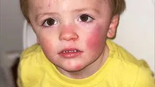 Mom Says Son Was Sucked Under Peloton Treadmill