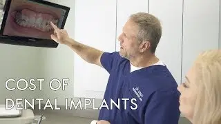 Things to consider when choosing who places your dental implants