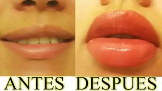 LABIOS MAS GRANDES! CON EXFOLIANTE CASERO | AANGIE
