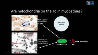 Rare Disease Day 2025 -Spotlight on Mitochondria: Power Plants on the Go in IIMs Dr. Christian Lood