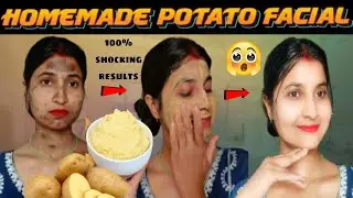 DIY Potato Facial For Skin Whitening,Spotless &Clear Skin:हफ़्ते में 1बार लगालो चेहरा होगा😯गोरा..