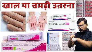 खाल या त्वचा निकलना | Skin Peeling | Skin Disease | Medicine | Treatment | Pharmacy | Doctor | MBBS