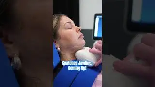 CoolSculpting: A Win&nbsp;For The Double Chin