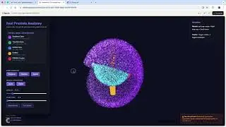 Prostate 3D Point Cloud Mapper