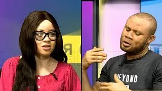 How To Live In Nigeria As An Albino