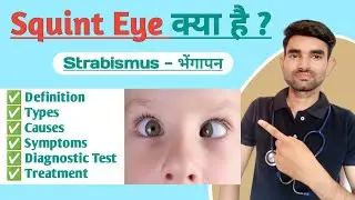 Squint Eye Lecture in Hindi | Causes, Symptoms And Treatment of Squint Eye