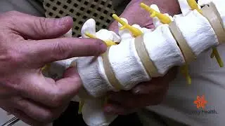 Motion Preservation in the Lumbar Spine (HB 555)