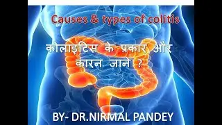 CAUSES & TYPES OF COLITIS.       कोलाइटिस के प्रकार और कारन जाने ?
