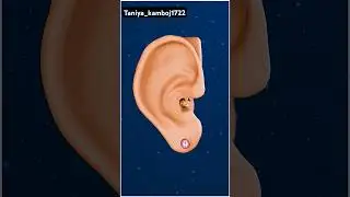 Bad effect of ear buds #earsbud#shortsvideo #microscop🔬#sciencefacts #3danimation