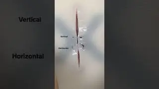 Vertical Mattress Suture #surgicalskills #suturing #surgery #surgeon #medicine