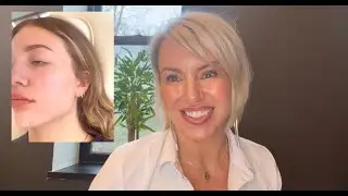 Facial Balancing | Jen Marie, Master Injector and Owner of Skin Esteem
