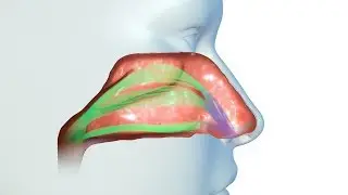 Vivaer nasal airway remodeling - CornerStone ENT - Charlotte & Monroe, NC
