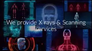 Digital X- Ray Scanning- Best Diagnostic Centre in Hyderabad