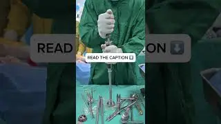In Total Hip Replacement (THR), preparing the acetabulum cup is one of the most crucial steps. 🦴