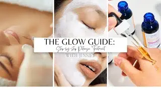 The Glow Guide: Step By Step Potenza RF Microneedling Treatment!
