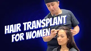Hair Transplant for Women - Dr. Resul YAMAN