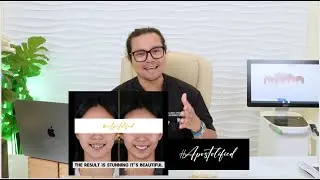 Destroyed to Restored Smile | Veneers, Crowns and Fixed Bridge | Apostol Dental Philippines