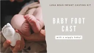 Making a Luna Bean Foot Cast (It even works with a wiggly baby!)