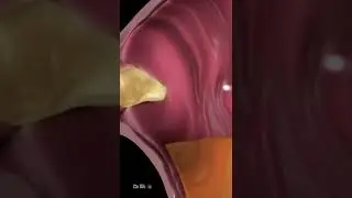 Что произойдет с вашим телом, если вы будете есть лимоны каждый день