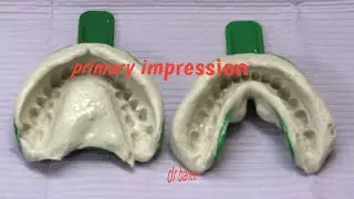 primary impression in fixed prothodontics