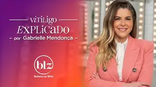 Vitiligo: o que &eacute;? com Dra. Gabrielle Mendon&ccedil;a I Beleza na Web