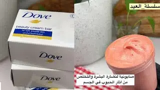 صابونية لنضارة البشرة والتخلص من آثار الحبوب بالجسم سلسلة عناية العيد ✨ خلطات جدتي