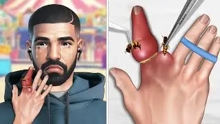 [ASMR Animation] Help Drake fix the ring stuck by the bee sting
