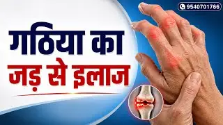 गठिया की होम्योपैथिक दवाएं|Homoeopathic medicines for Rheumatoid Arthritis|Arthritis| जोड़ो के दर्द 