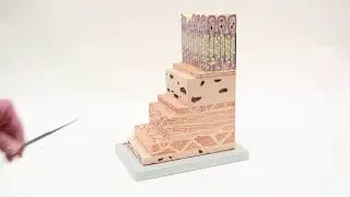 Stomach Wall Model