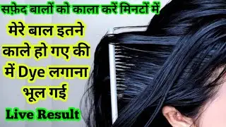Turns white hair into black with in 1 hour..home remedies to treat grey hair ⚫🙏💯black dye 