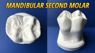 Carving of Mandibular Second Molar (Tooth Morphology)