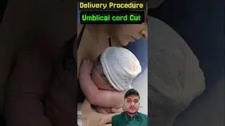 Normal delivery Process #babybirth #birthprocess #babydelivery #labourpain