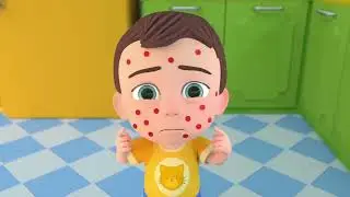 Baby Sick Song ｜ Pretend Play  |  Nursery Rhymes & Kids Songs