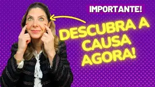 Olhos Amarelados - Causas Dos Olhos Amarelos