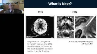 Walter Koroshetz - Early Days of the NIH BRAIN initiative
