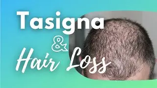 Tasigna and hair loss / Thinning hair / Alopecia / Nilotinib / CML / Chronic Myeloid Leukemia