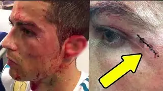 When Cristiano Ronaldo Lost Control - TOP 13 Moments