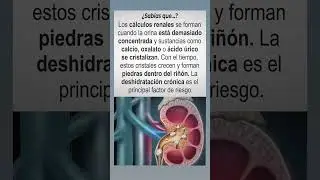 &iquest;Por qu&eacute; salen los c&aacute;lculos renales?